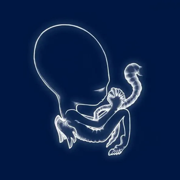 Sigur Ros: Agaetis Byrjun